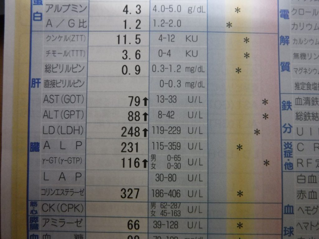 床下 屋根裏に入っての検査 は必須検査